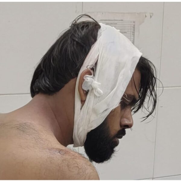 किरकोळ वादातून तरुणावर जीवघेणा हल्ला